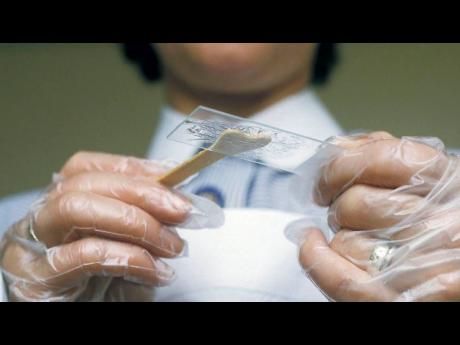 Credit: File Pap smear screening is effective in preventing cervical cancer