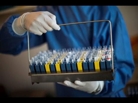 A lab technician carries samples from patients to be tested for coronavirus, COVID-19, at the CHU Liege Hospital in Liege, Belgium, on Tuesday, November 3, 2020.