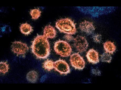 Credit: AP FILE – This 2020 electron microscope image provided by the National Institute of Allergy and Infectious Diseases – Rocky Mountain Laboratories shows SARS-CoV-2 virus particles which cause COVID-19, isolated from a patient in the US, emerging from the s