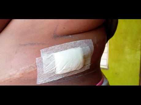 The Manchester market vendor who was shot during a high-speed chase in mid-May shows a bandage on one of several wounds she sustained. 