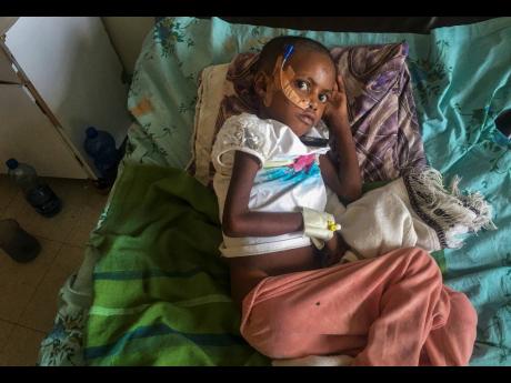 Genet Mehari, five, is being treated for malnutrition but with limited medicine, at the Ayder Referral Hospital in Mekele, in the Tigray region of northern Ethiopia.