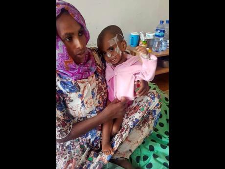 Selam Mulu, two, is treated for malnutrition at the Ayder Referral Hospital in Mekele, in the Tigray region of northern Ethiopia, on Tuesday.