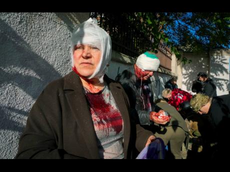People receive medical treatment at the scene of Russian shelling in Kyiv, Ukraine, yesterday.