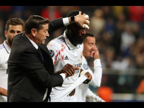 Blood runs down the face of Real Madrid’s Antonio Rudiger (centre) during the Champions League group F soccer match between Shakhtar Donetsk and Real Madrid at Polish Army Stadium stadium in Warsaw, Poland, yesterday.