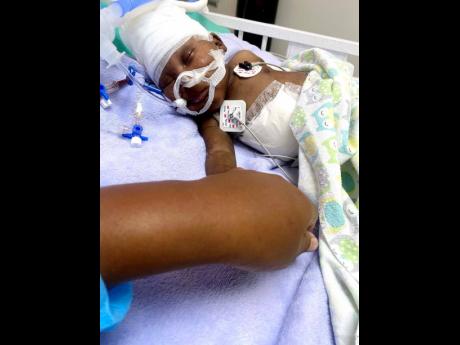 Four-month-old Rovaire Shirley, who has undergone eight surgeries, is touched by his mom while lying in bed at the Bustamante Hospital for Children. 