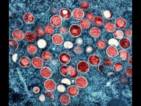 This image provided by the National Institute of Allergy and Infectious Diseases (NIAID) shows a colorised transmission electron micrograph of monkeypox particles (red) found within an infected cell (blue), cultured in the laboratory that was captured and 