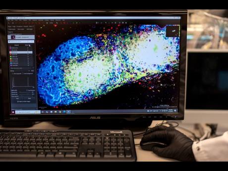 Research fellow Sachin Surwase shows an image of a pancreatic lymph node from a mouse in the lab where he studies autoimmune diseases at Johns Hopkins University in Baltimore, Maryland.