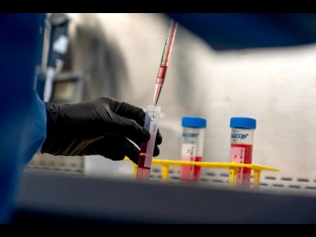 Dr Justin Kwong, a research fellow who coaxes human stem cells to grow into a kind of immune cell involved in autoimmune diseases, works in a lab at the National Institutes of Health in Bethesda, Maryland.